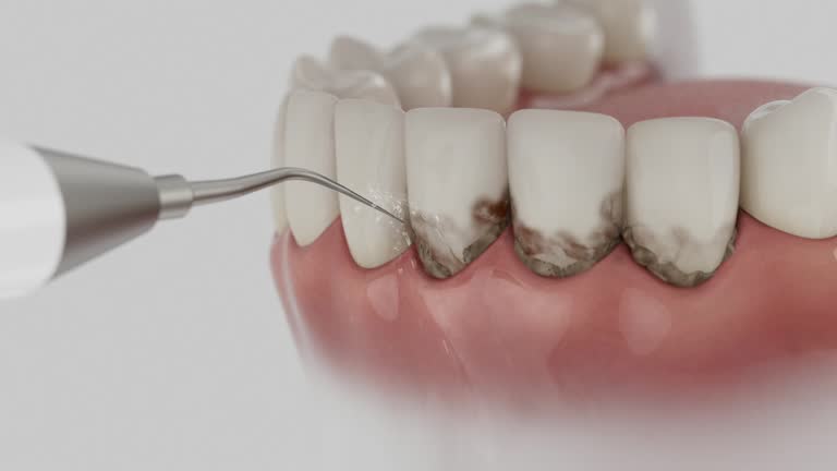 Trusted Dental Crowns And Bridges service in Unionville, NC - Dentist Open Now